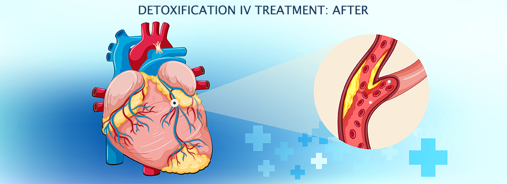 chelation1